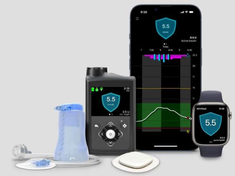 Medtronic 780G connected with the Simplera sensor, smartphone, smartwatch, and infusion set