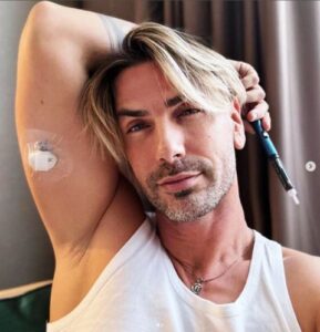 Marko Cibbocci dancer and a type 1 diabetic