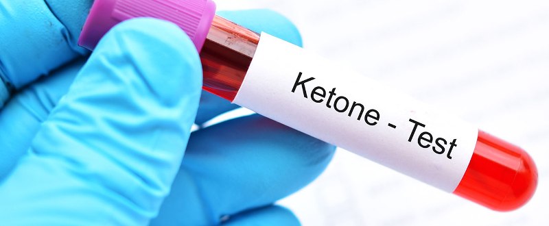 ketones test