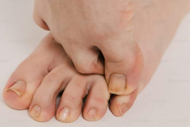 feet